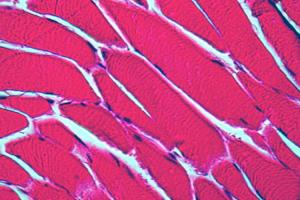 muscle tissue under a microscope