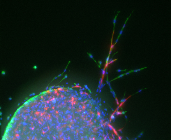 This image shows vascular sprouting from mouse lung tissue planted on a hydrogel.