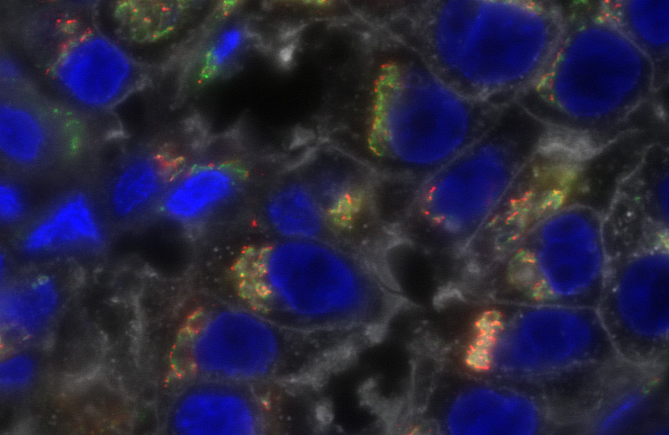 high-resolution fluorescence image of breast cancer cells with stained organelles