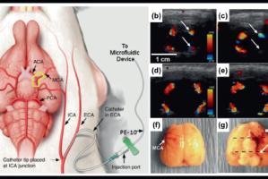 Advancing Ultrasound Applications