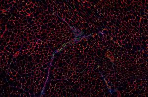 A histology image of a skeletal muscle cross-section