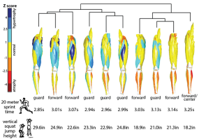 segmented muscles from MRIs