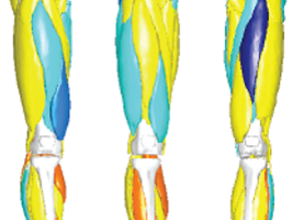 Segmented MRI model of lower limb muscles