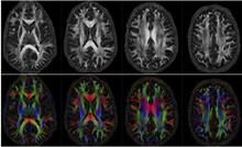 brain connectivity