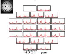 mri cbig
