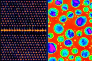 electron microscope image 