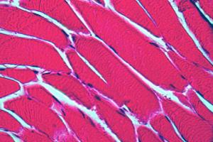 muscle tissue under microscope