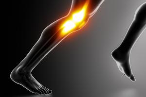 abstract diagram of a runner's injured knee