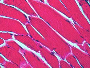 muscle tissue under a microscope